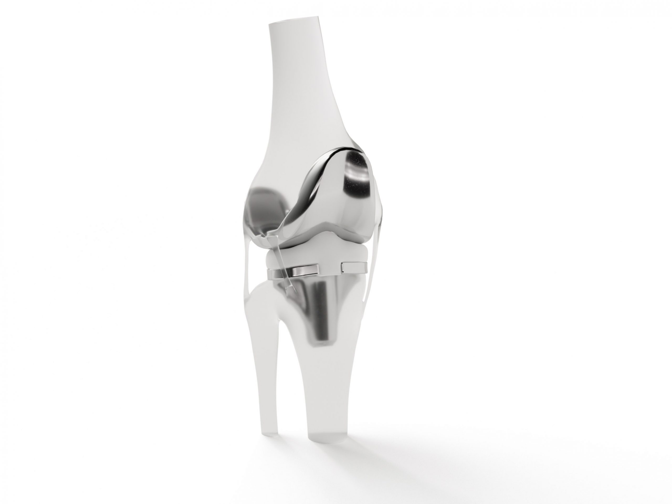 3D rendering of an artificial knee joint with a metallic implant surface on a white background.