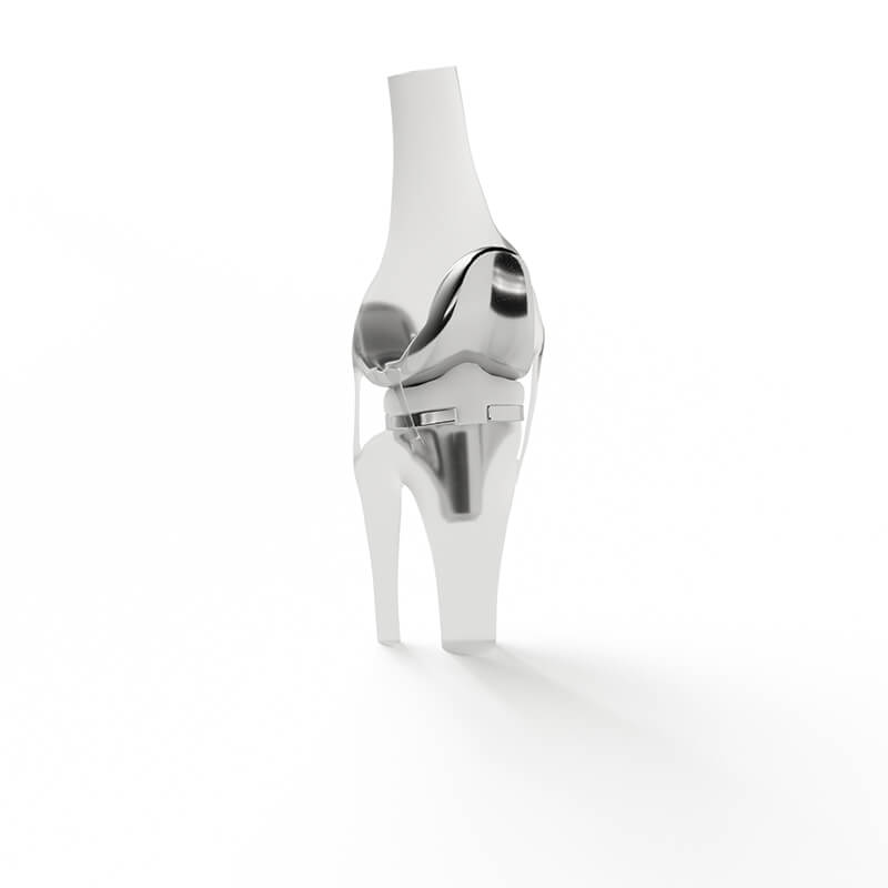 Orthopedics