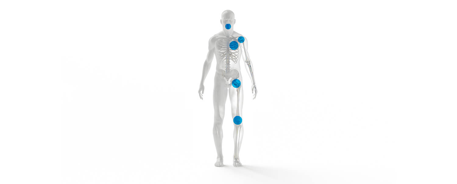 A rendition of a human body, showing bones and blue circles for points of interest.